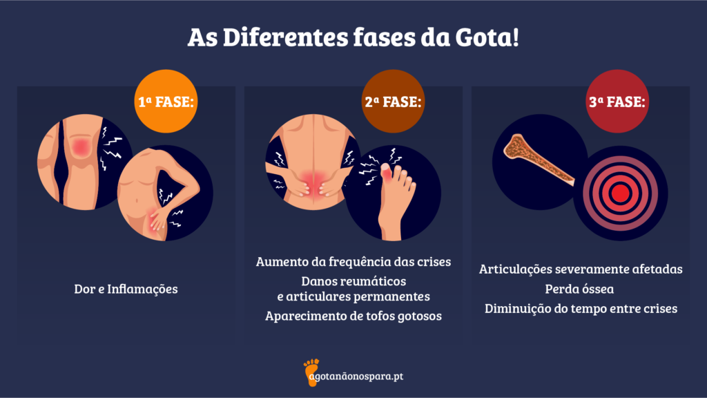 Descubra as diferentes fases da Gota!